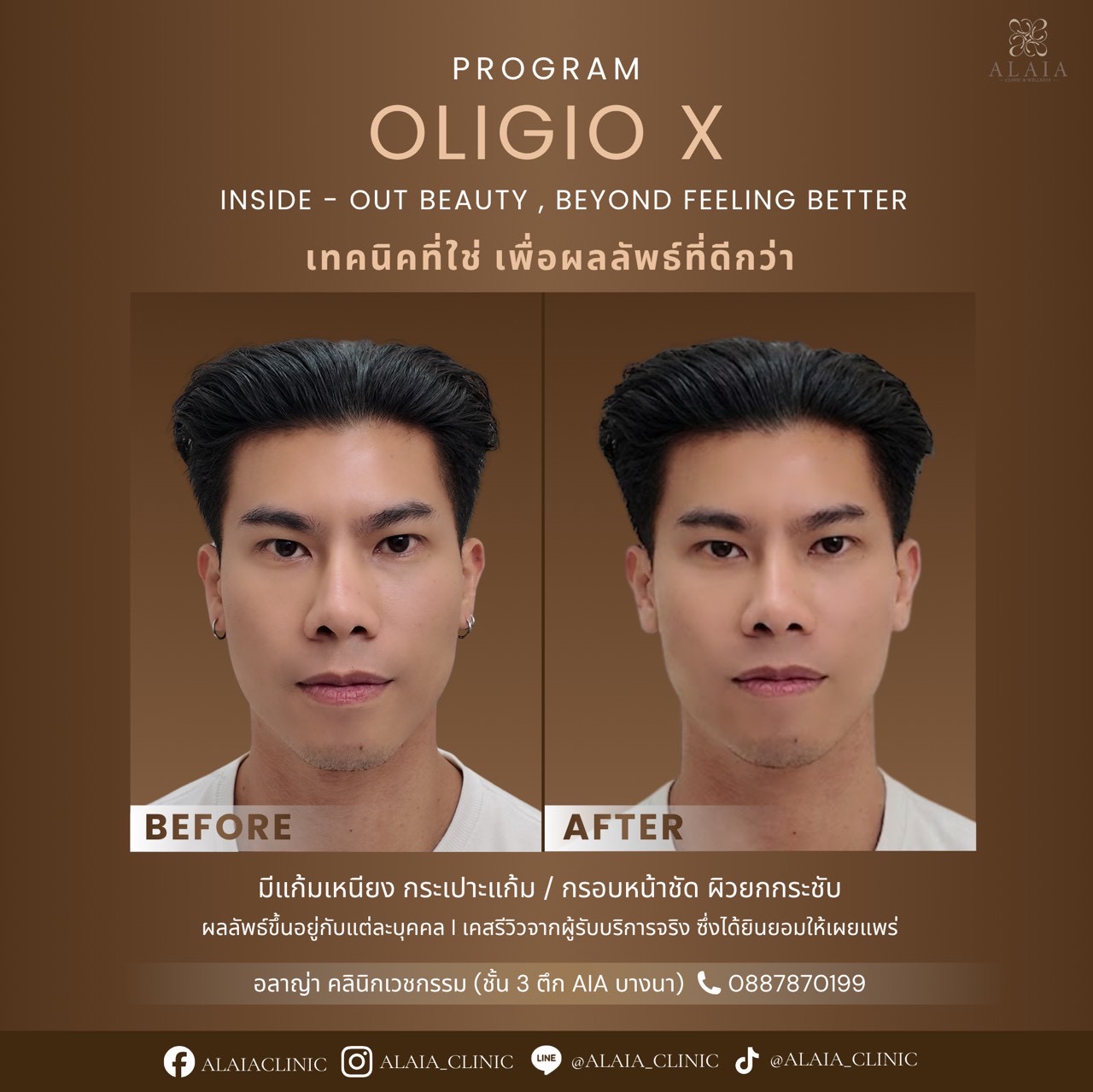 Oligio X Real Result 4